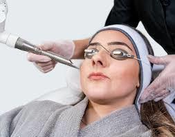 RF Facial